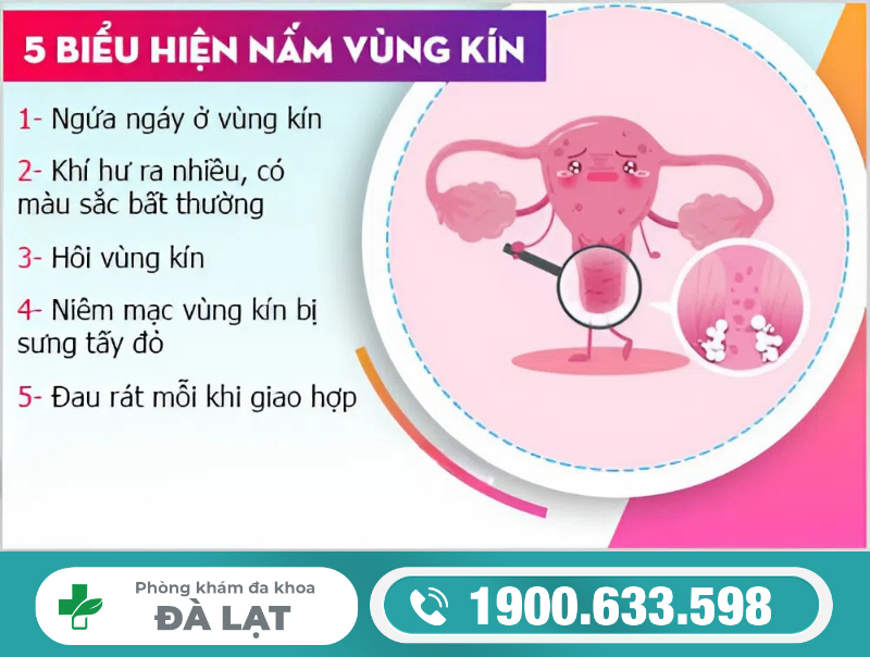 Hình ảnh minh họa